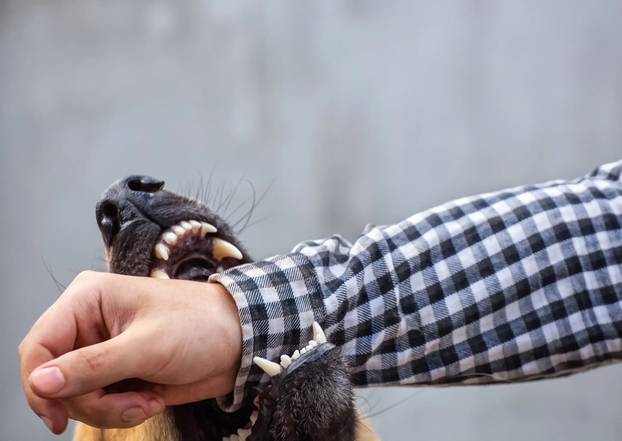 Dog Bite Attorney Near Me
